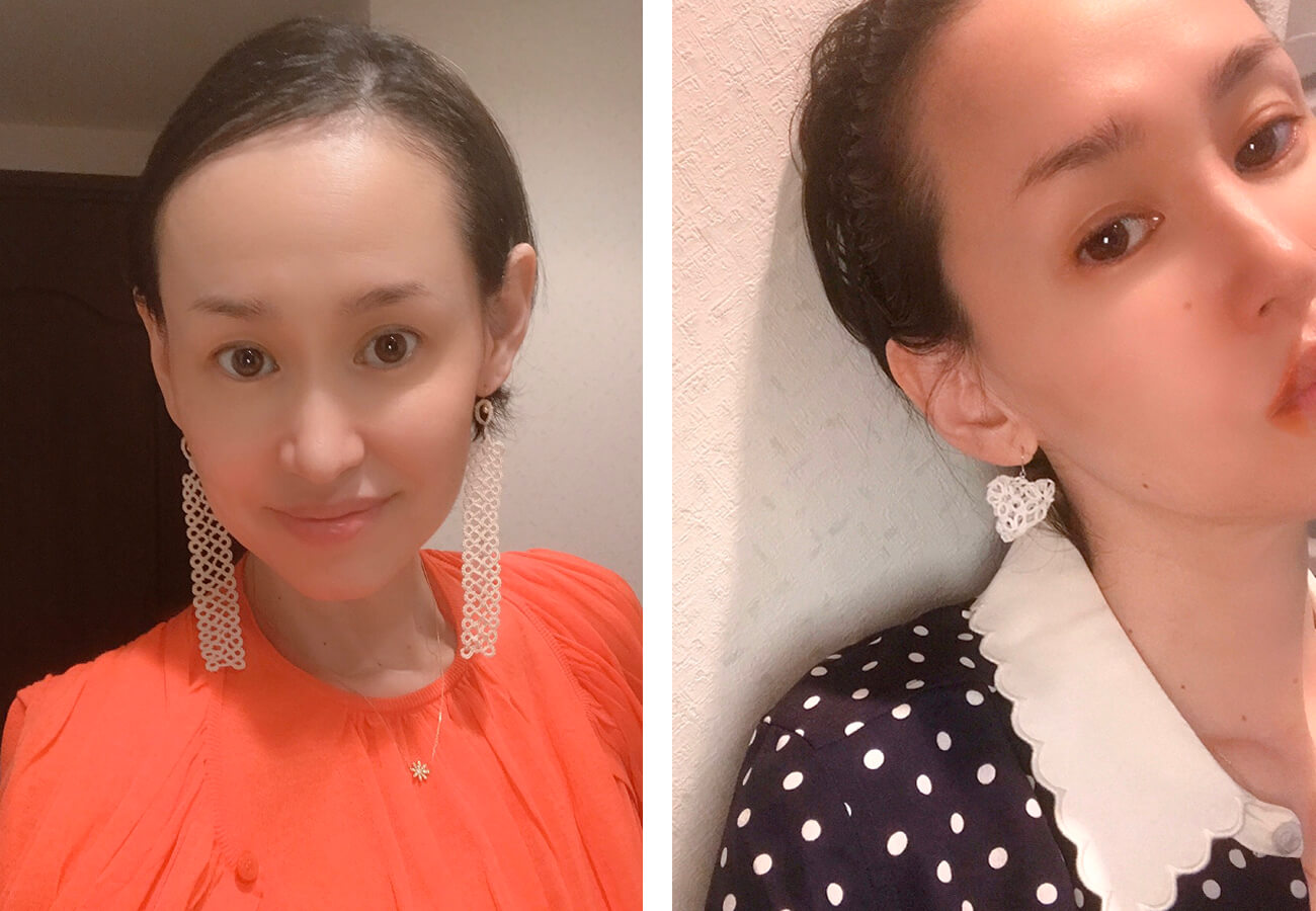 橋本奈美子さんインタビュー がん闘病 後編 自分なりに納得できる方法で乗り越えて Lee