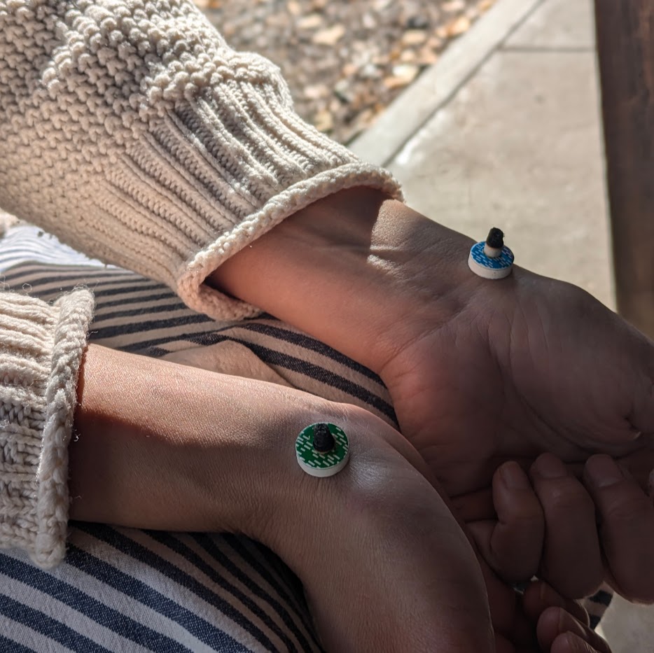 ハゴロモ治療院　お灸　体験