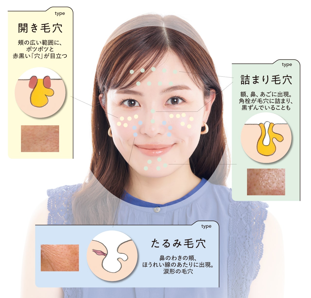 毛穴解説イラスト