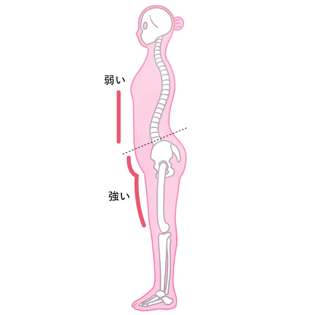 反り腰イラストカット