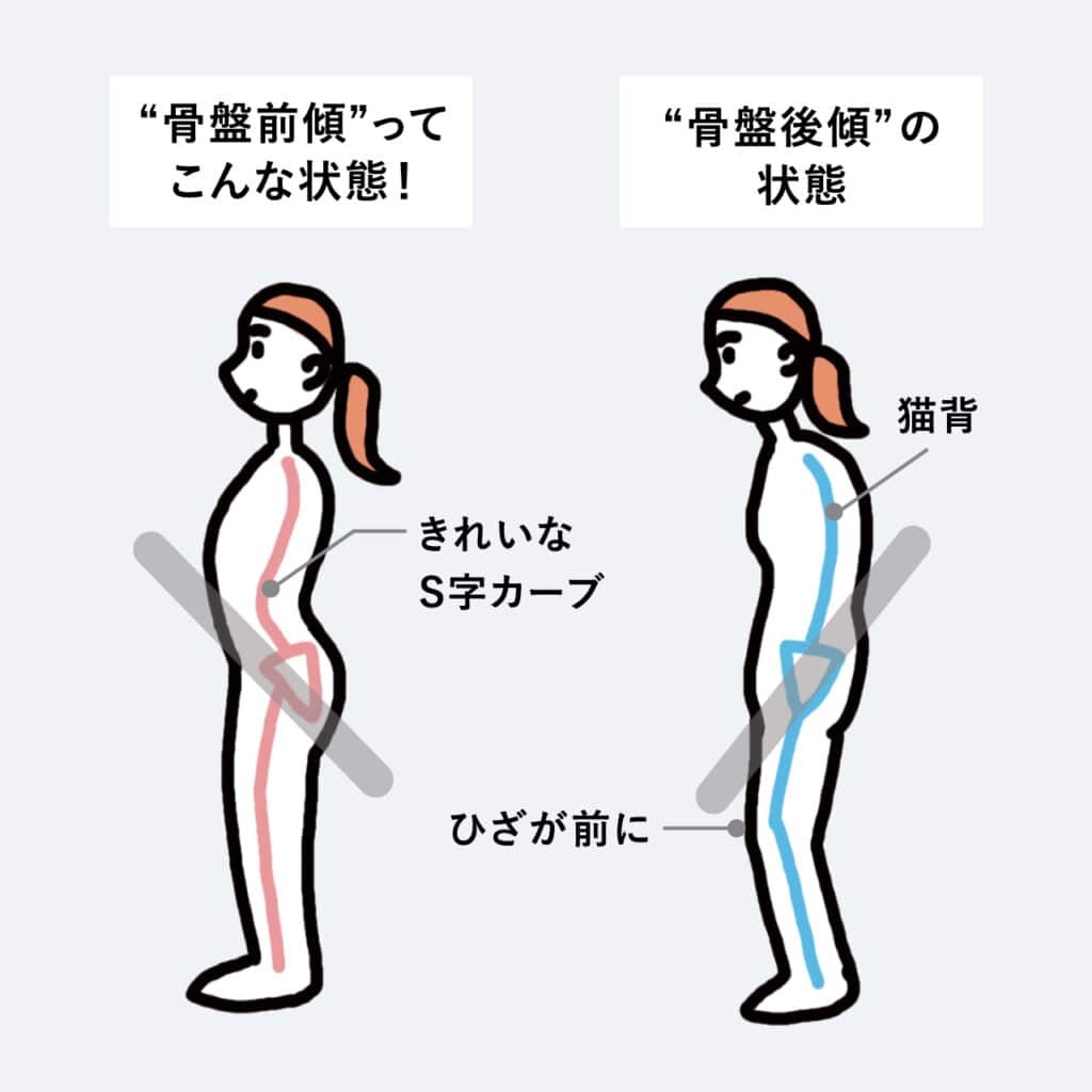 “骨盤後傾”の状態...猫背、ひざが前に
“骨盤前傾”ってこんな状態！...きれいなS字カーブ