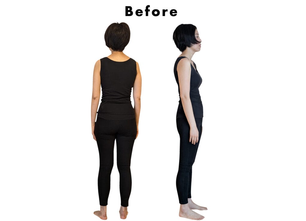 LEE100人隊 No.029 Yukapoさん Before