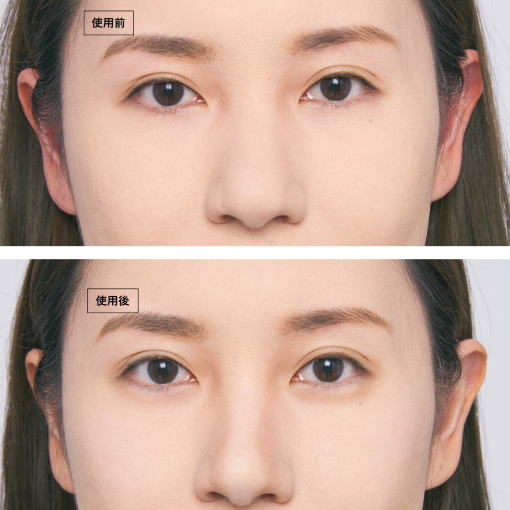 使用前後の写真