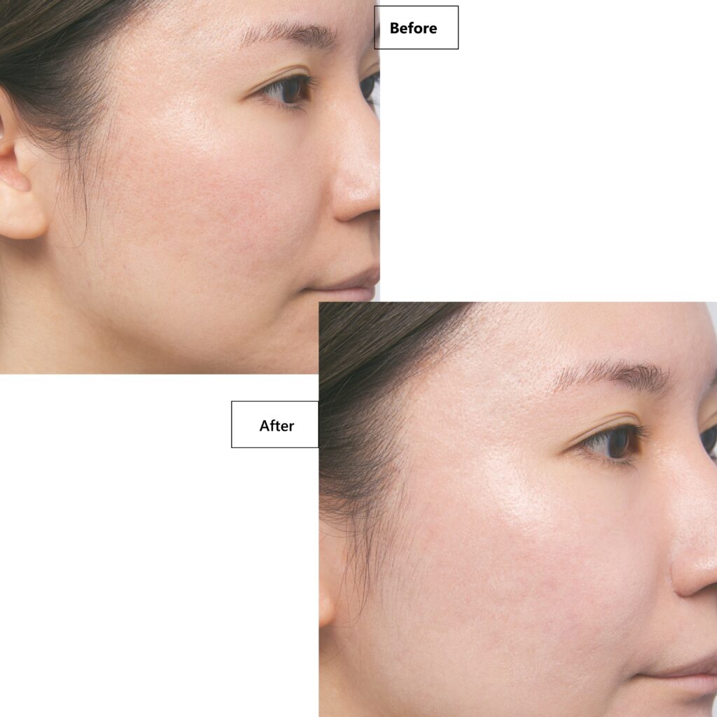 エッセンスベース EXの使用前と使用後。