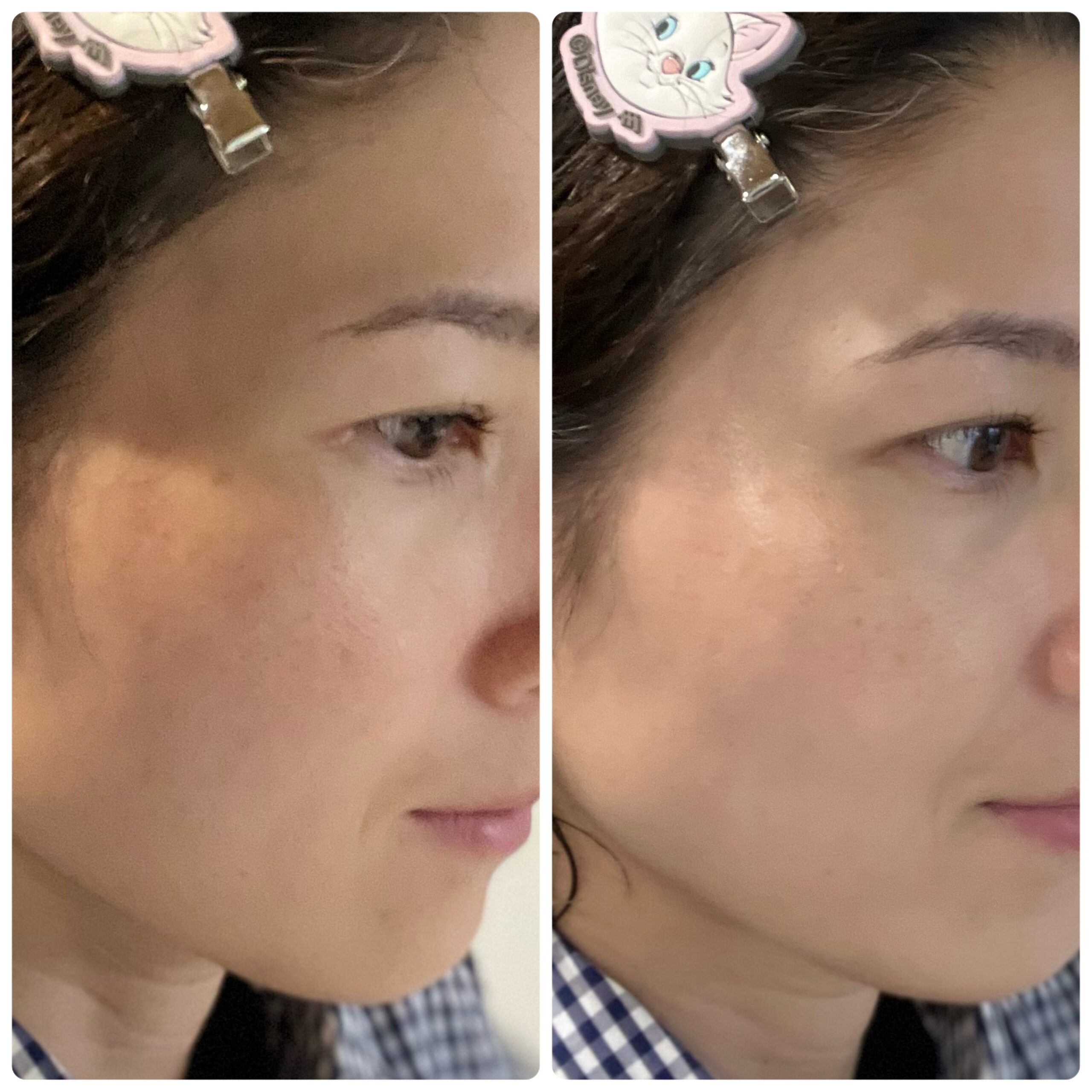 ファンデーション　顔