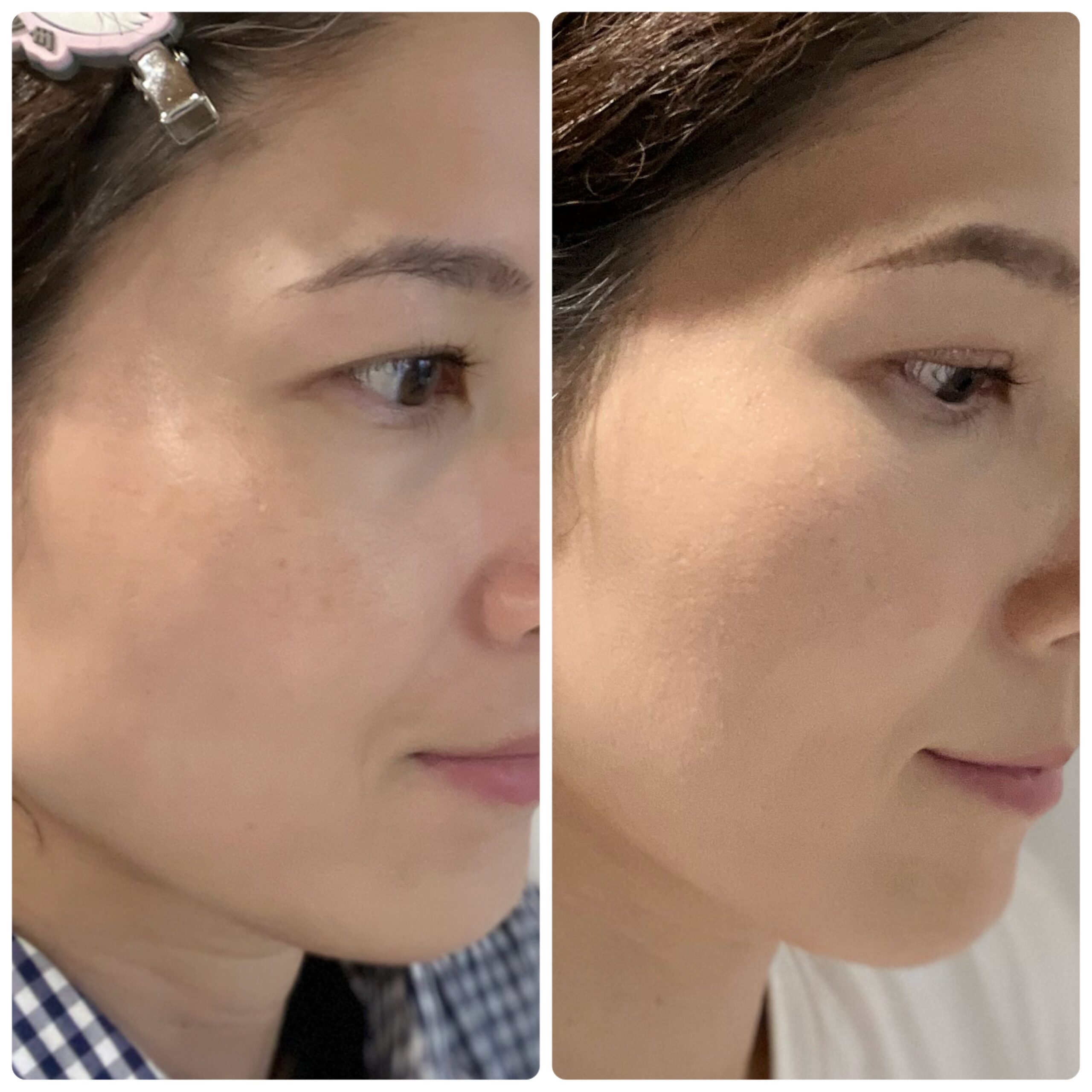 顔　ファンデーション