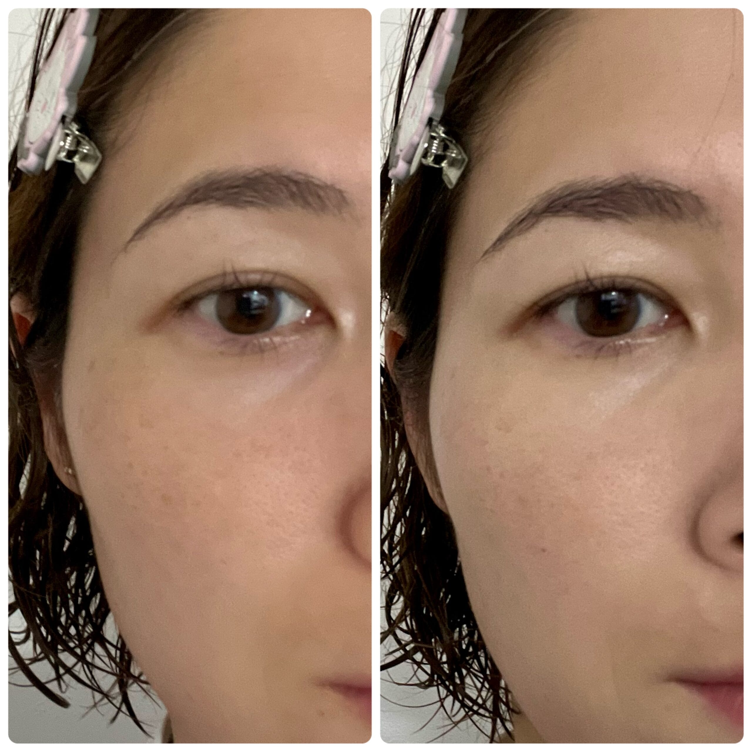 顔　コンシーラー