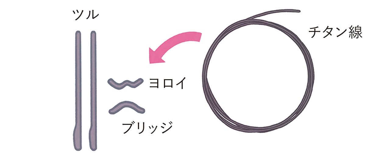 ツル　チタン線　ヨロイ　ブリッジ