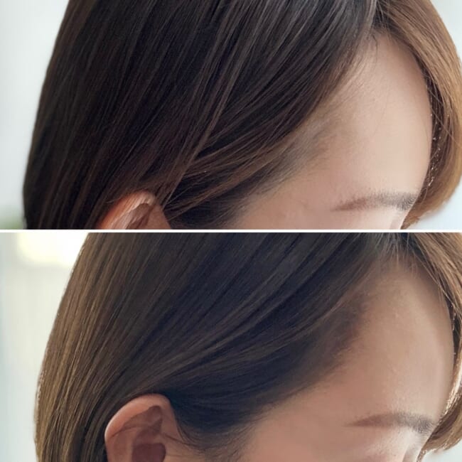 レカルカの「イルミネイトマルチ」