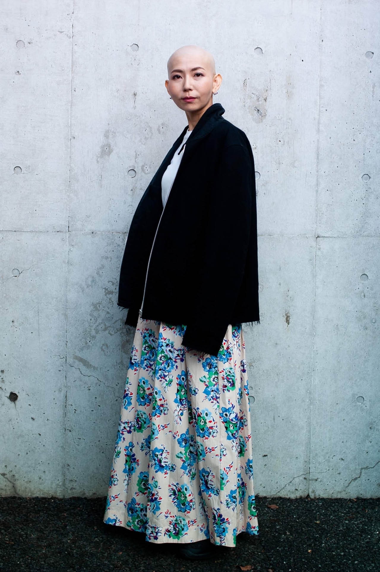 抗がん剤治療で髪の毛がなくなった姿