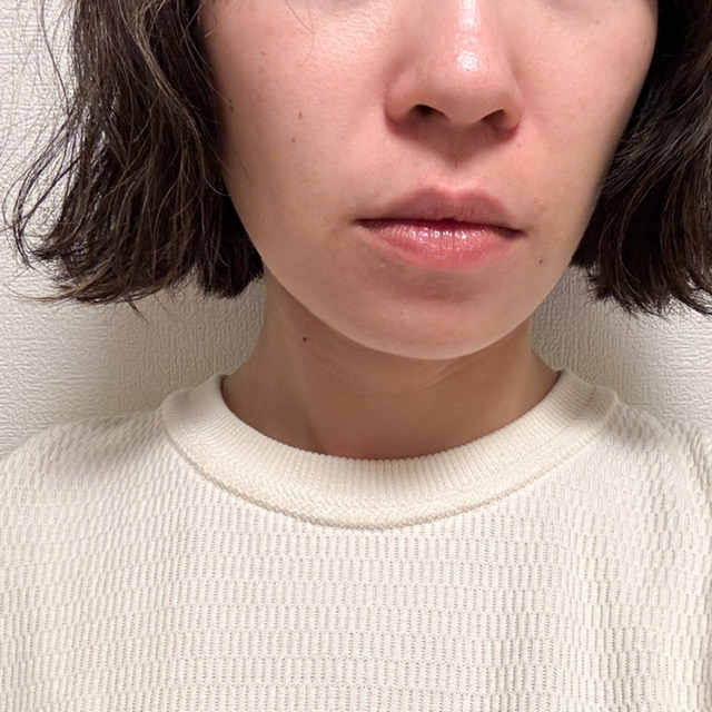 メディプラス ノイズカットリップパックを塗布して15分経ち唇が透明になった写真