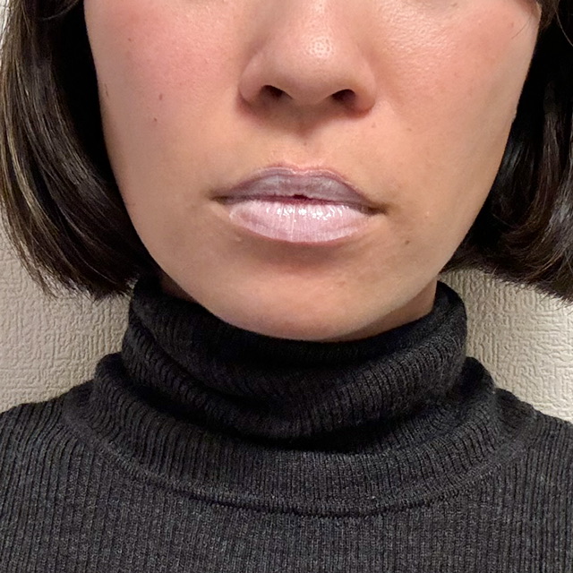 メディプラス ノイズカットリップパックを塗布して唇が真っ白な写真