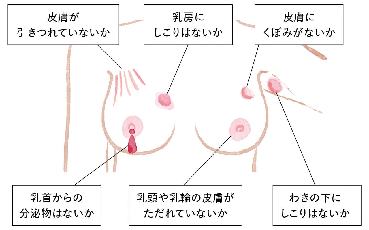 乳がんの早期発見のための「ブレスト・アウェアネス」
【胸部の図】ここをチェック！
皮膚にくぼみがないか、乳房にしこりはないか、皮膚が引きつれていないか、わきの下にしこりはないか、乳頭や乳輪の皮膚がただれていないか、乳首からの分泌物はないか