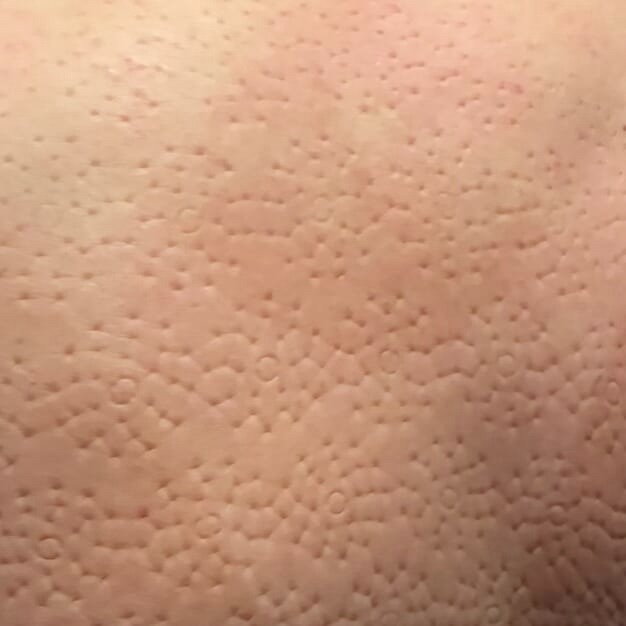 「究極のシャクティセット」（ORIGINAL）を使った後の肌