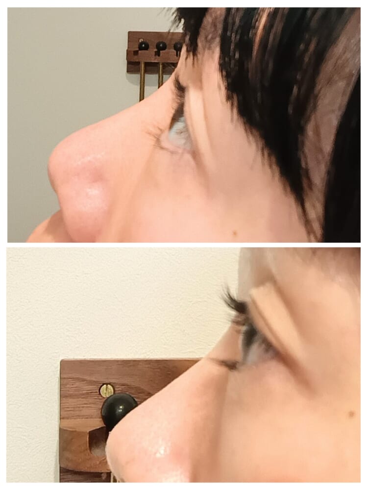 インプレア アイラッシュ セラム　まつ毛　美容液3