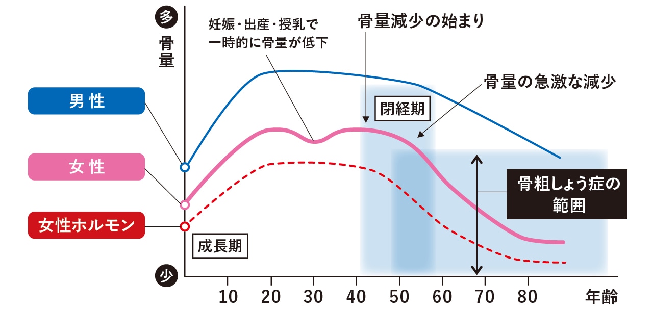 年齢と閉経に伴う骨量の変化 (概念図)