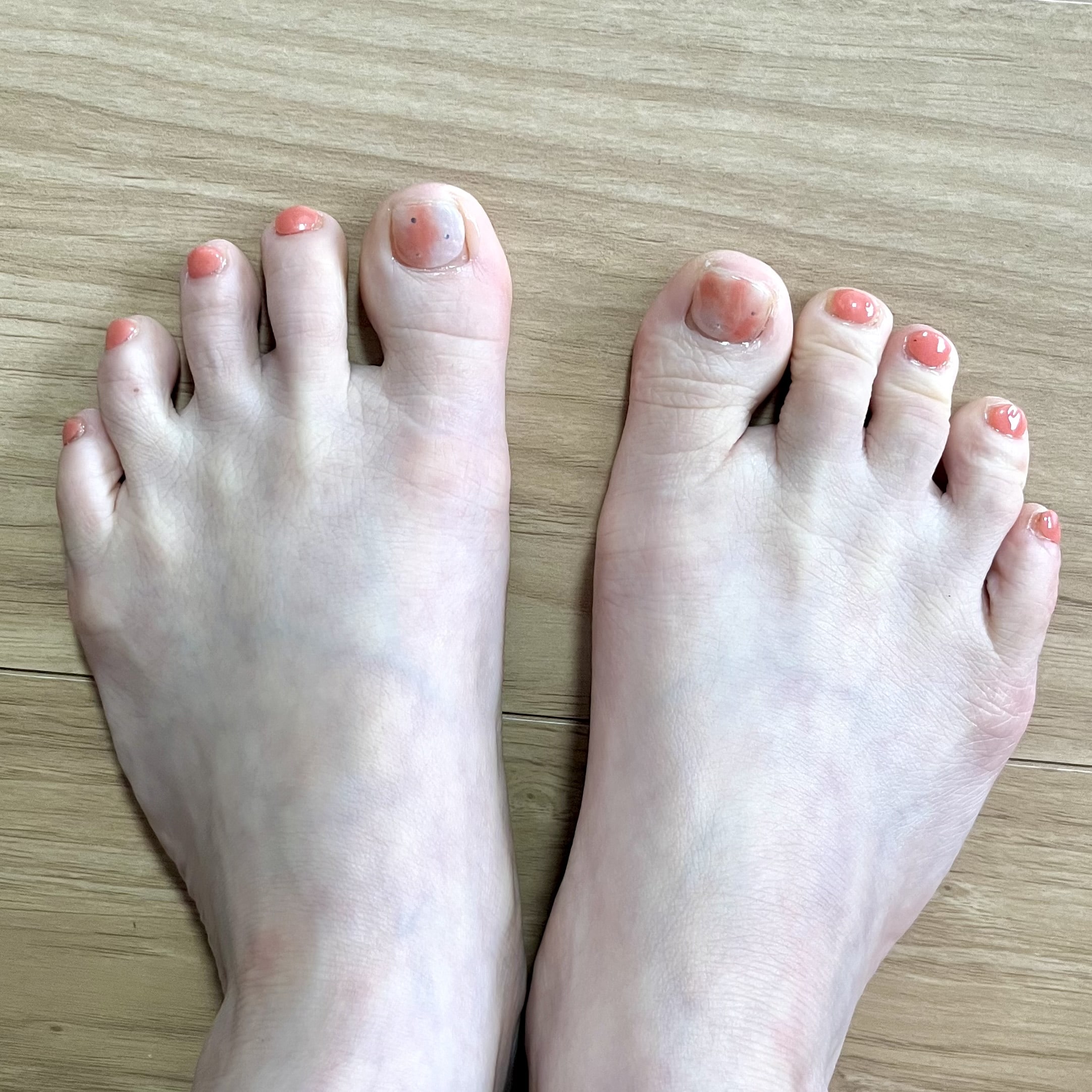 ネイル