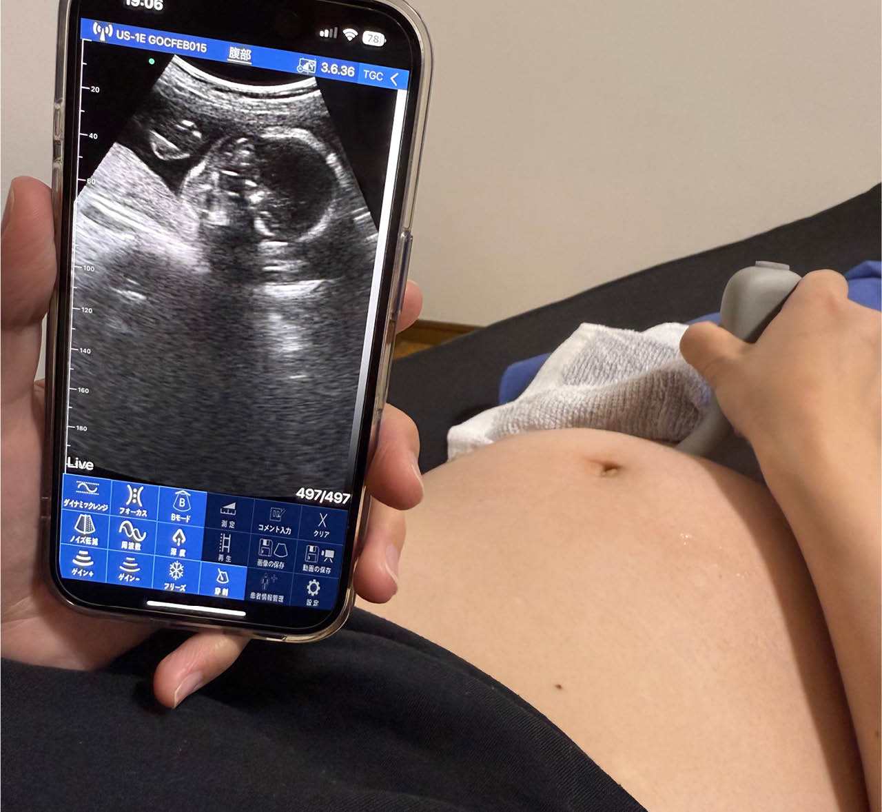 スマホでポケマムとアプリ連携し、胎児の様子や心音を自分で確認できる