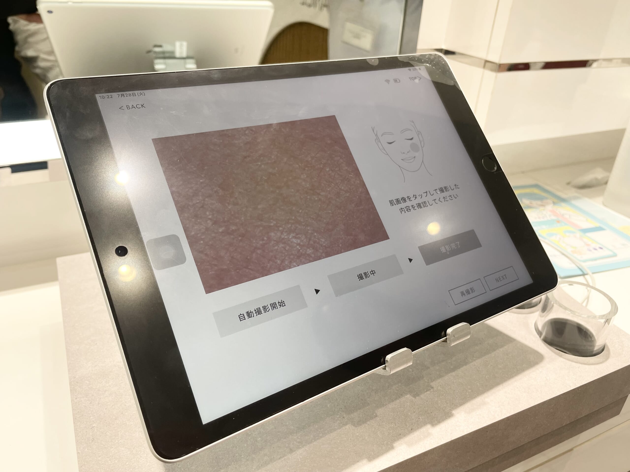 ファンケルのスキンチェックスコープ測定・肌表面拡大写真をiPadに写した様子。