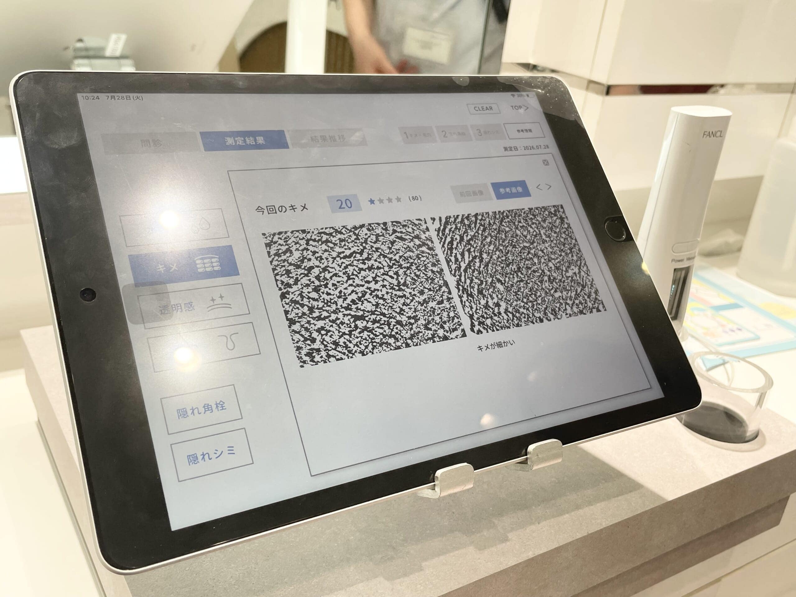 ファンケル(FANCL)キッズ肌カウンセリング中の画面。右はキメが細かい肌、左は今回スコープで撮ったキメが粗い肌の表面