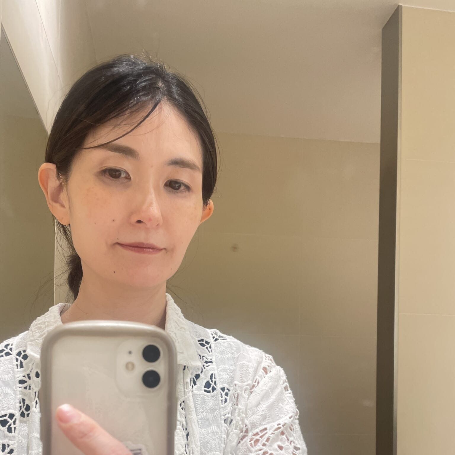 TBおゆうさん 肌の調子観察記録用の写真